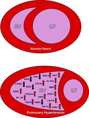 Oxidative Stress and Its Implications in the Right Ventricular Remodeling Secondary to Pulmonary Hypertension